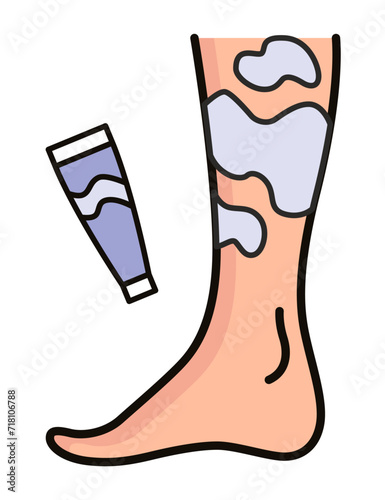 Varicose treatment icon. Violation of circulatory system. Vascular disease diagnostic. Venous insufficiency medical disease. Vector illustration