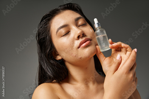 young and brunette asian woman with acne prone skin holding bottle with serum on grey background