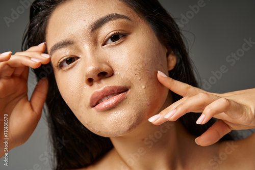 portrait of young asian woman with brunette hair and acne on wet face posing on grey background photo
