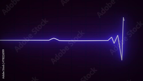 Sinus arrhythmia heartbeat rhythm, illustration Electrocardiogram photo