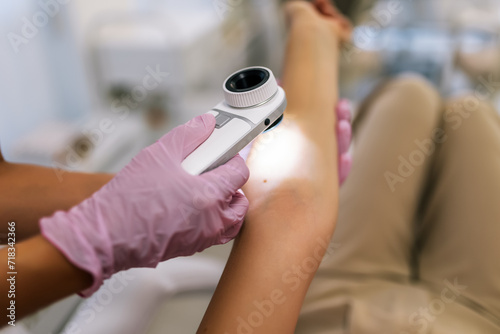 Fotografija The dermatologist examines the moles or acne of the patient with a dermatoscope