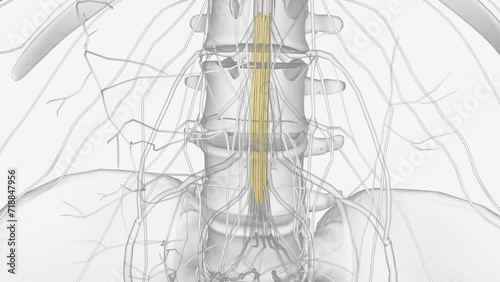 Cauda equina syndrome occurs when the nerve roots in the lumbar spine are compressed, cutting off sensation and movement . photo