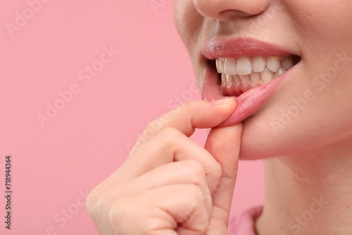 Beautiful woman showing her clean teeth on pink background  closeup. Space for text