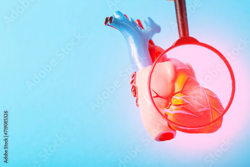 Medical mock-up of a heart under a magnifying glass on a blue background. Heart disease concept, inflammation of the heart muscle, myocardial infarction, coronary heart disease. Copy space for text