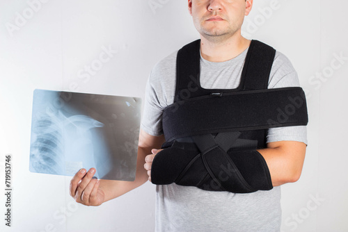 A man in a black bandage supporting the shoulder joint after surgery holds in his hand an x-ray of a dislocated shoulder and a broken arm. Rehabilitation after a clavicle fracture injury.  photo