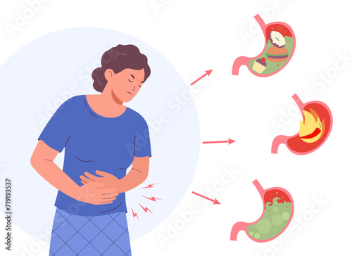 Diseases of stomach. Stomach pain, gastritis, heartburn. Gastric acid reflux, gastric bloating.