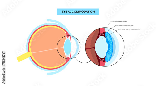 Eye accommodation poster © pikovit