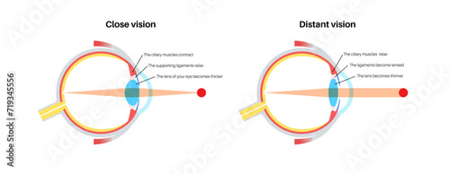 Eye accommodation poster