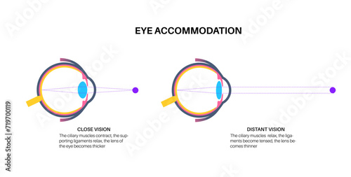 Eye accommodation poster