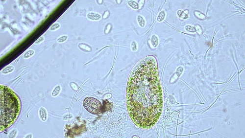 fresh water ciliate, Paramecium bursaria, surrounded by smaller ciliates and bacteria. 400x magnification, phase contrast microscopy photo
