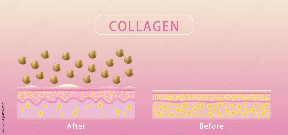Collagen , Before and after process of getting skin, Protection Skin vector