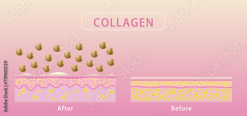 Collagen , Before and after process of getting skin, Protection Skin vector