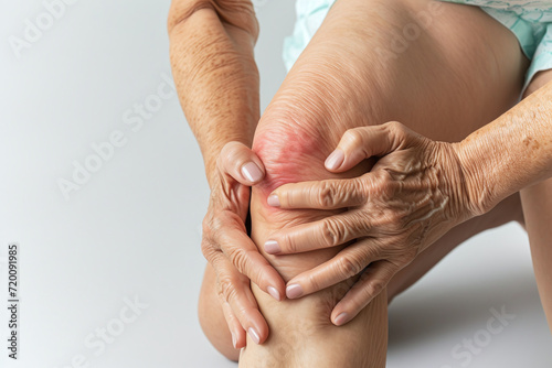 Acute knee pain in an elderly woman, arthrosis bone disease photo