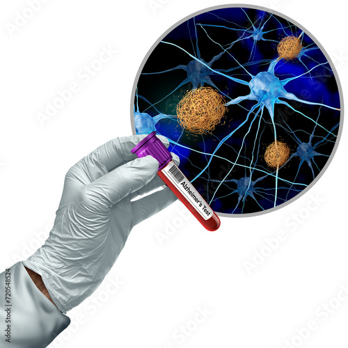 Alzheimers Blood screening Test Diagnostics and Alzheimer Dementia analyzing for early detection of brain cognitive disorders as amyloid testing for protein biomarker as medical Alzheimer's neurodegen photo