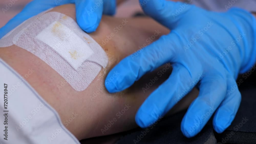 The nurse applies medicated ointment to a hematoma in the knee area