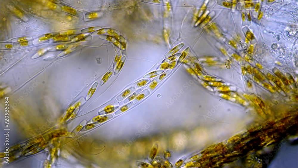 Rare footage of a marine diatom colony, enclosed in filamentous