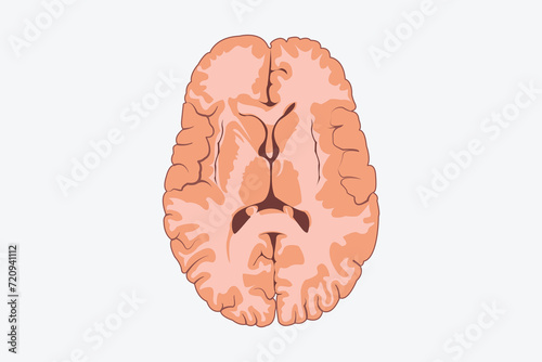 Horizontal cross sections through cerebrum. cross section of human brain.