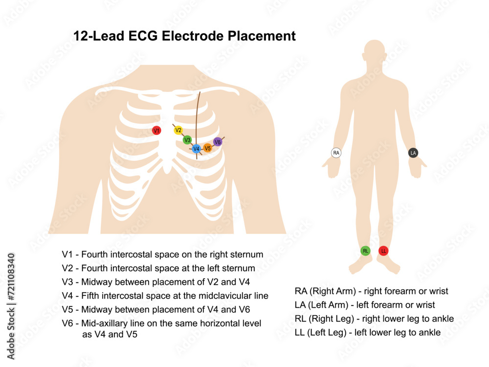 Electrocardiogram. Placement of 12lead ECG electrodes on the human