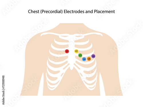 Electrocardiogram. Chest (Precordial) Electrodes and Placement. Heart cardiogram. Vector illustration in flat style isolated on white background