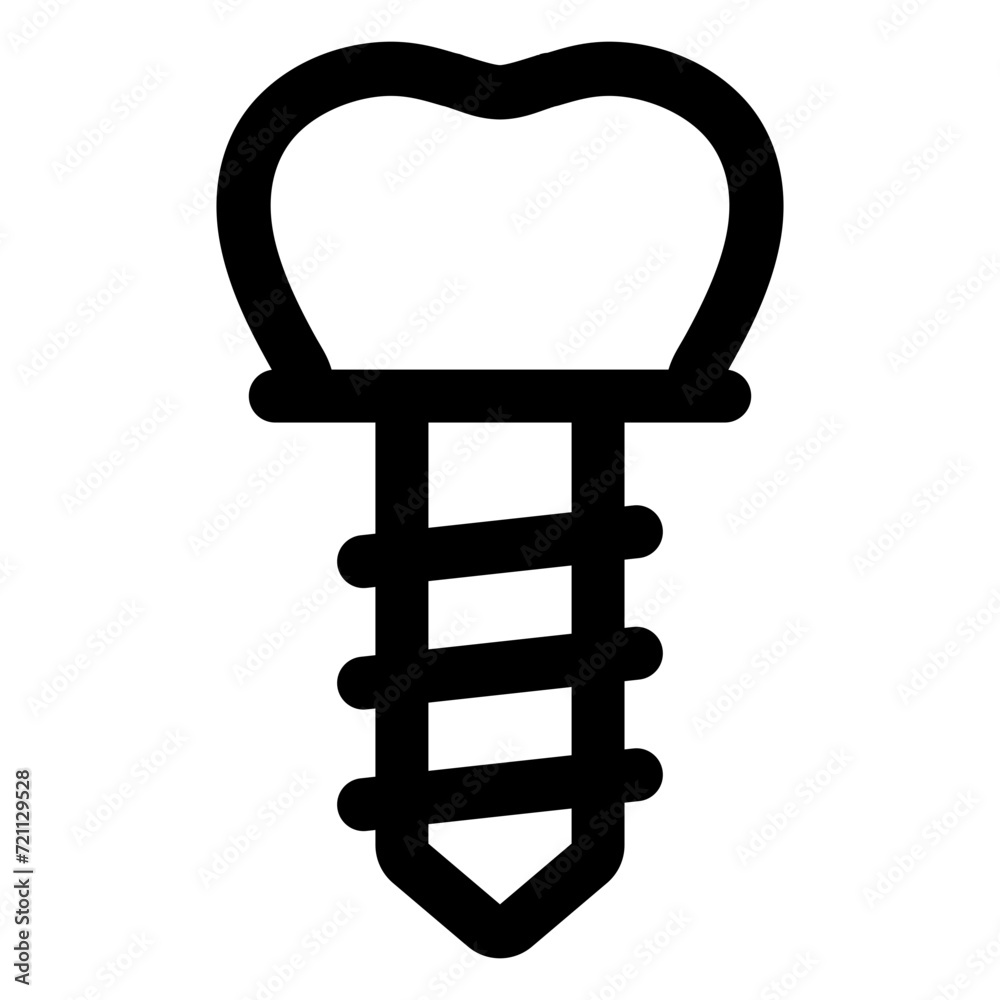 implant implant
