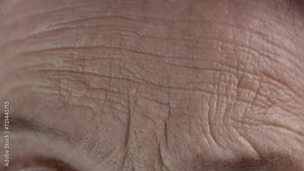 Woman's forehead with deep wrinkles Woman's forehead with deep wrinkles