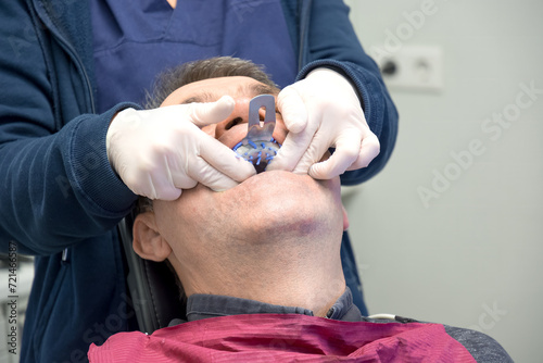 Canvastavla Real shot of a man with a dental impressions tray in a dentist's chair