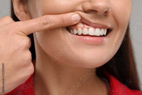 Woman showing her clean teeth on light grey background, closeup