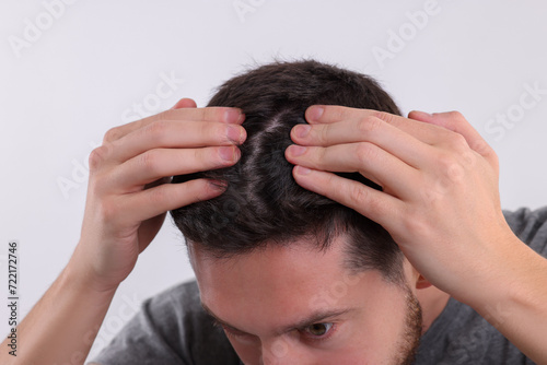 Man examining his hair and scalp on white background, closeup