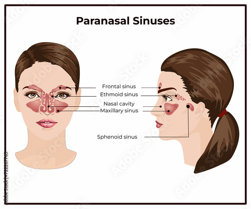 Sinusitis, Woman's face with inflammation of the mucous membrane of the paranasal and frontal sinuses. Front view of the thyroid gland and trachea on a white background. Human body organs anatomy