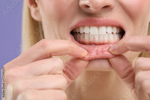 Woman showing her clean teeth on violet background, closeup view