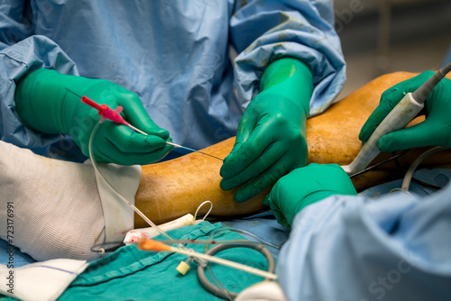 Process of varicose vein surgery in hospital, vein sealing, venous vascular surgery, phlebectomy surgery, surgical field marking, superficial veins problems, swollen skin, step by step