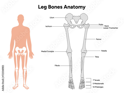 Leg bones position Blowlegged knockkneed