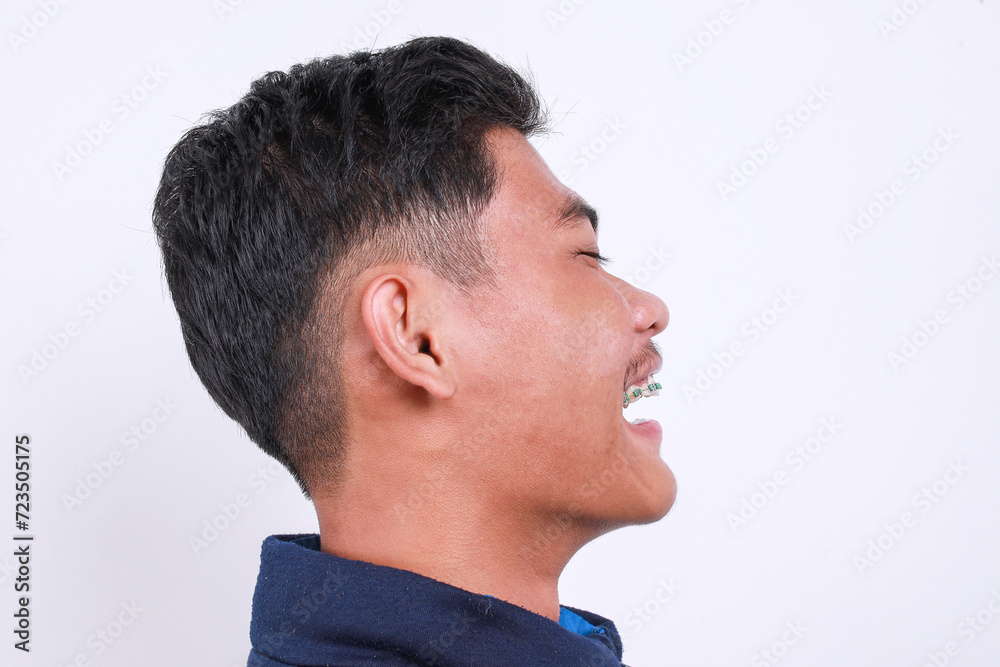 Close-up view of young man in short hair and wear braces teeth laughing isolated over white background Close-up view of young man in short hair and wear braces teeth laughing isolated over white background