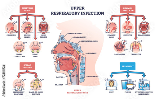Upper respiratory infection with symptoms and types outline diagram, transparent background. Labeled educational health condition scheme with coughing, sore throat and nasal problems illustration. photo