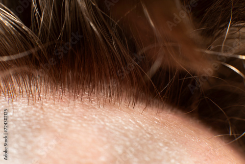 The Hair line on the man forehead - macro close up