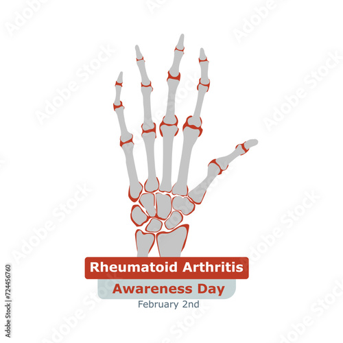 Rheumatoid Arthritis Awareness Day. Rheumatoid arthritis symptom on human joints and bones. Vector, illustration.