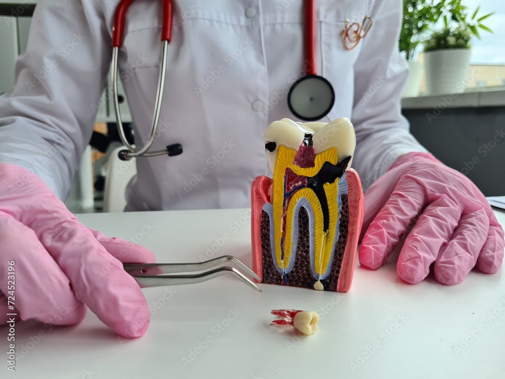 © Nadzeya - Close-up of a dentist holding a tooth model and showing it to the patient.