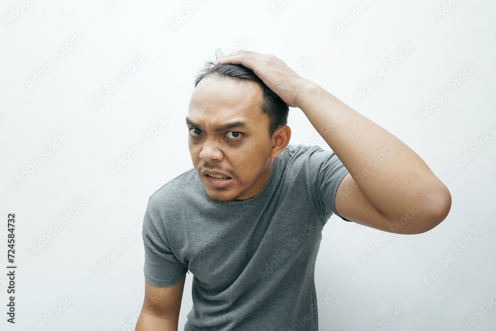 Asian man frustrated for getting bald and falling hair Asian man frustrated for getting bald and falling hair