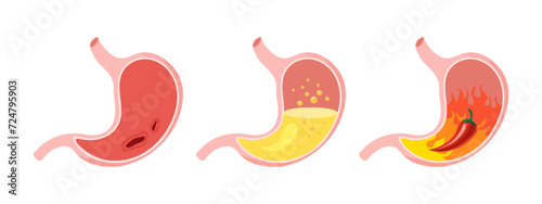 Unhealthy human stomach, medical icons set. Gastritis, ulcer, stomach pain, bloating. Anatomy of the digestive system. Vector