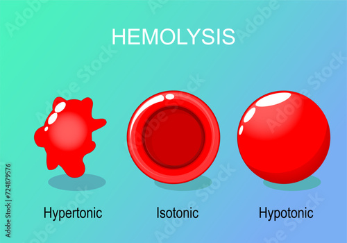 Hemolysis of Red blood cells.