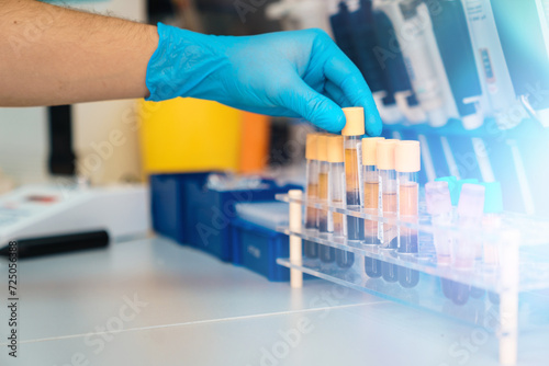 Biochemist analyzing blood samples at the lab taking a test tube from the rack. photo