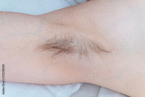 Closeup of long dark hair growing under arm of young female. Concept of hygiene  natural beauty  feminity and body hair growth