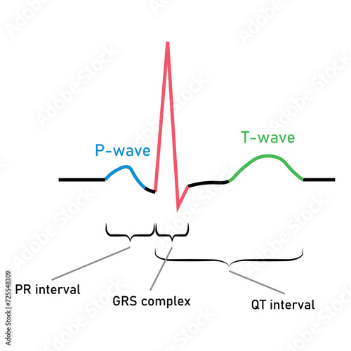 Ventricular repolarization, T wave. The QT interval of ECG. The cardiac cycle. ECG of a heart in normal sinus rhythm. Resources for teachers and students.