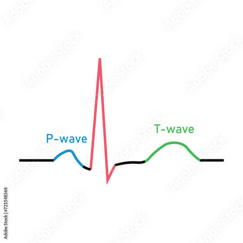 Ventricular repolarization, T wave. The QT interval of ECG. The cardiac cycle. ECG of a heart in normal sinus rhythm. Resources for teachers and students.