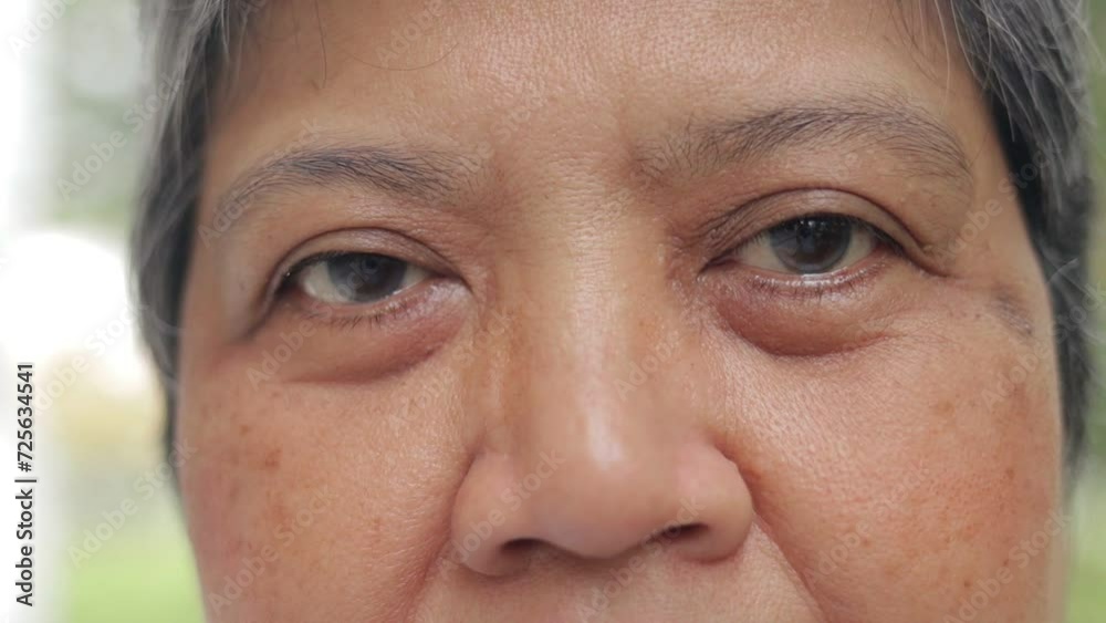 Close-up view of the eyes of an elderly Asian woman. Eye disease in the elderly. health problems Close-up view of the eyes of an elderly Asian woman. Eye disease in the elderly. health problems