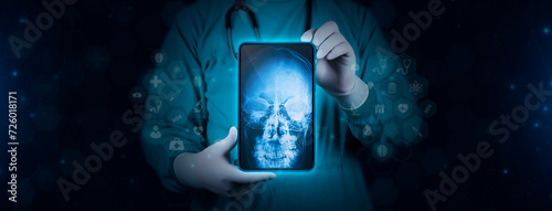 The doctor holds a tablet and examines a posteroanterior (PA) x-ray of the paranasal sinuses. The doctor analyzes the frontal and ethmoid sinuses. Technological digital background