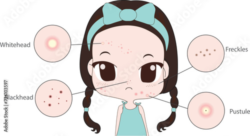 Troubled woman and set of most common female facial skin problems needs to care about: acne ,Freckle and dull skin.
