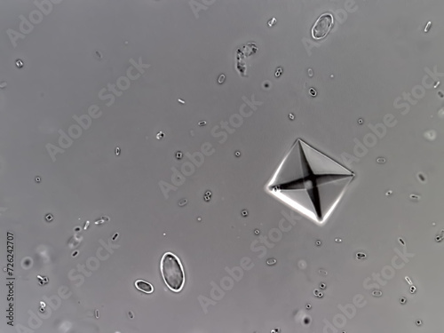 Photos Calcium oxalate crystal from urine sediment.