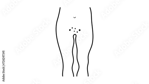 Genital rash, black isolated silhouette