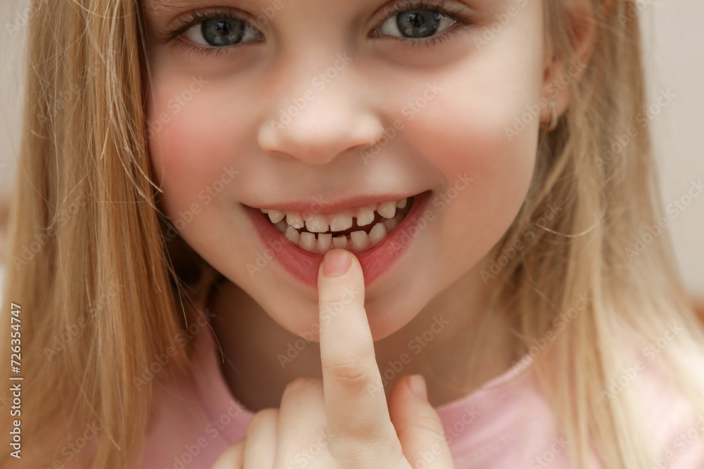 Cute preschool girl showing a loose primary (baby) tooth Cute preschool girl showing a loose primary (baby) tooth